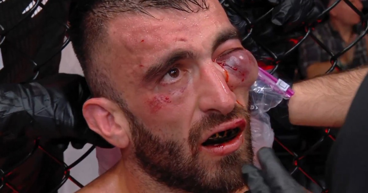 escalofriante-lesion-en-ufc-abu-dhabi:-mohammad-yahya-quedo-con-un-ojo-a-punto-de-explotar-y-pararon-su-pelea-con-steven-nguyen