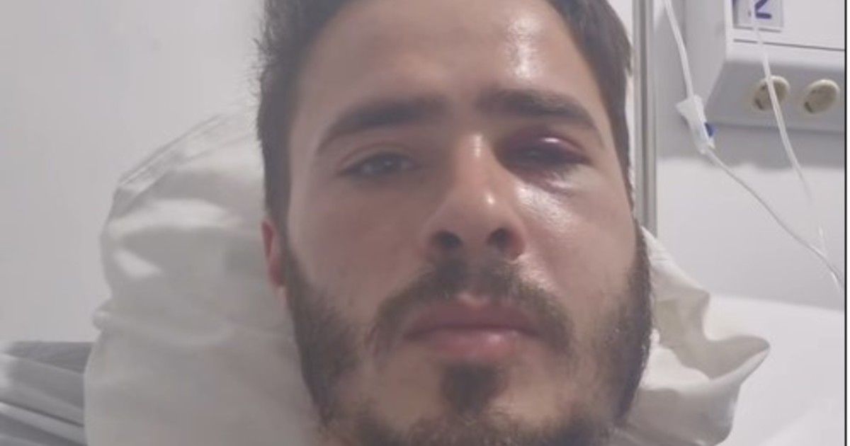 denuncian-al-hijo-de-un-concejal-kirchnerista-por-desmayar-de-una-trompada-a-un-hombre-que-confundio-con-un-militante-libertario