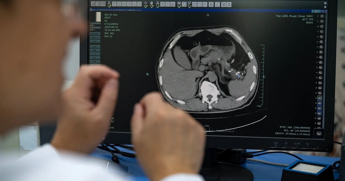 en-china,-la-ia-esta-detectando-tumores-mortales-que-los-medicos-podrian-pasar-por-alto