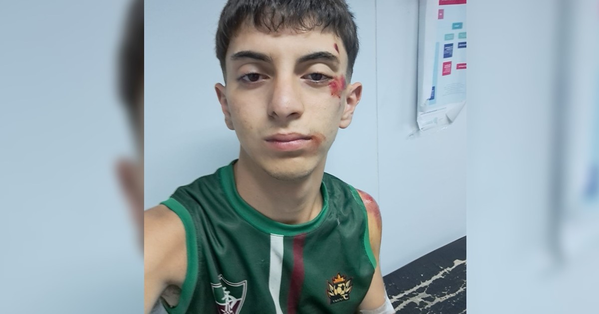 tiene-18-anos,-es-bombero-voluntario-y-salio-de-su-casa-al-sonar-la-sirena,-pero-le-robaron-la-bici-y-le-dieron-una-paliza