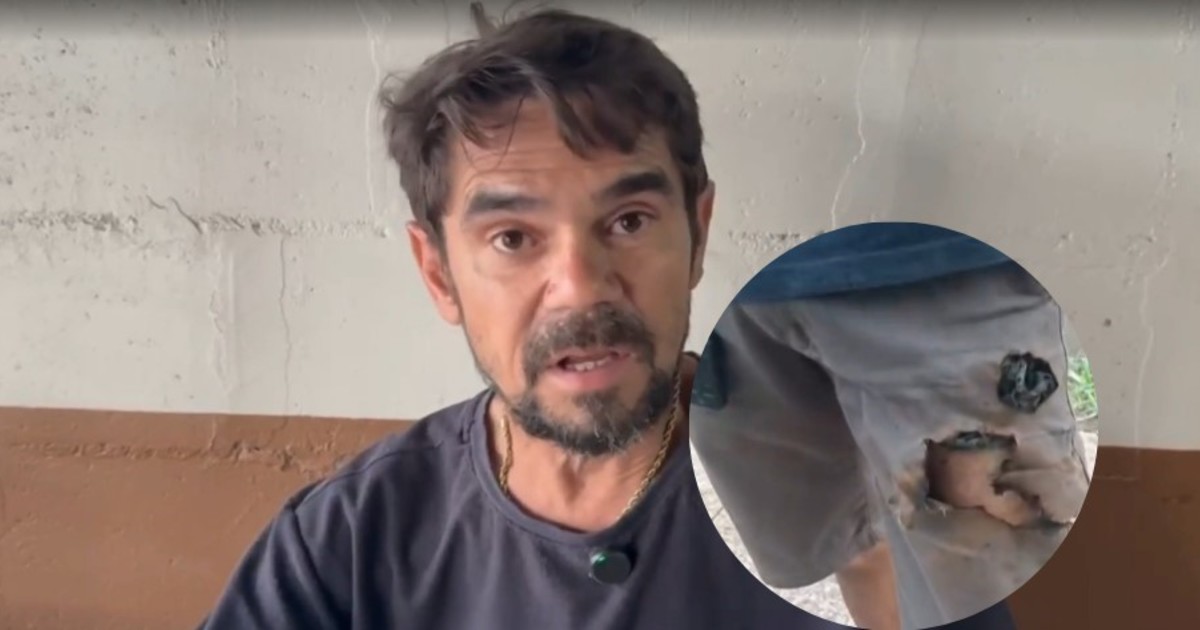 sufrio-el-ataque-de-dos-perros-en-la-calle-y-su-telefono-le-exploto-en-la-pierna:-«fue-peligroso,-pero-eso-me-salvo»