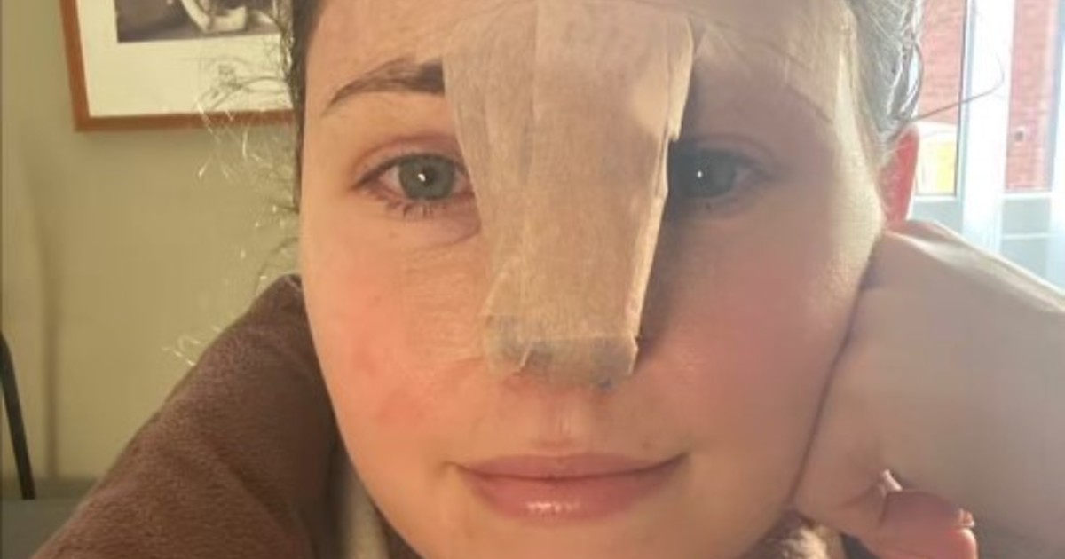 trabajaba-como-cuidadora-de-perros-y-sufrio-un-impactante-incidente:-«me-faltaba-gran-parte-de-la-nariz»