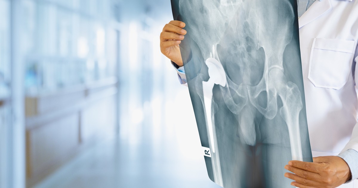 un-farmaco-experimental-puede-revertir-la-osteoartritis-en-semanas,-segun-demuestran-estudios-en-animales